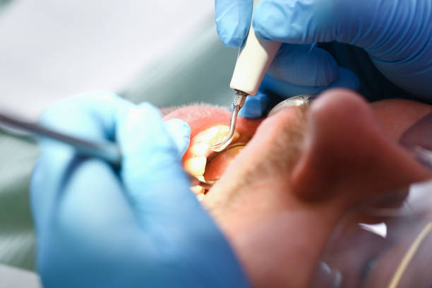 Best After-Hours Dental Trauma Care in Knoxvle, IL