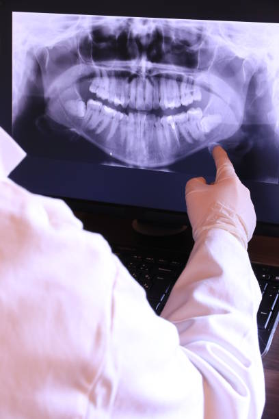 Best Emergency Tooth Extraction in Knoxvle, IL