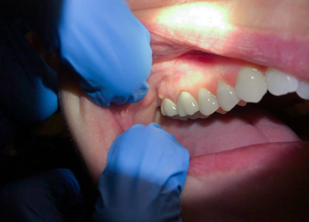 Best Emergency TMJ Treatment in Knoxvle, IL
