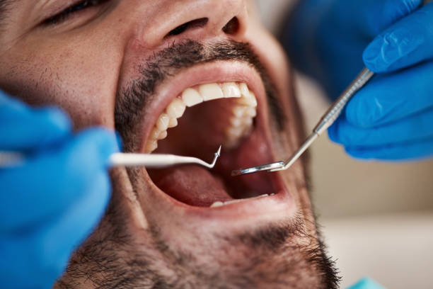 Best Cosmetic Emergency Dentistry in Knoxvle, IL