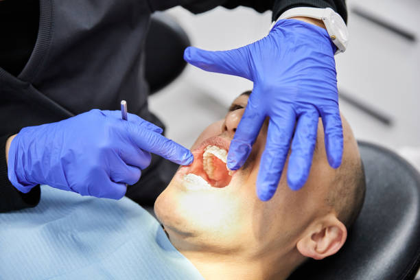 Best Emergency Wisdom Teeth Removal in Knoxvle, IL