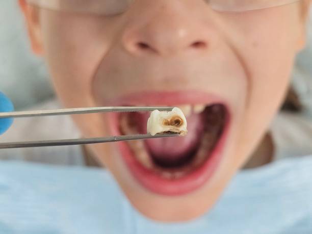 Best 24-Hour Emergency Dentist in Knoxvle, IL
