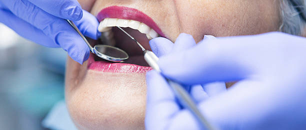 Best Emergency Dental Care for Broken or Chipped Teeth in Knoxvle, IL